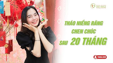 Niềng răng chen chúc, khấp khểnh mất bao lâu? - KH Đoàn Thị Ngọc Ánh 4379