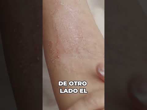 Ácido Cítrico Vs. Ácido Sulfúrico