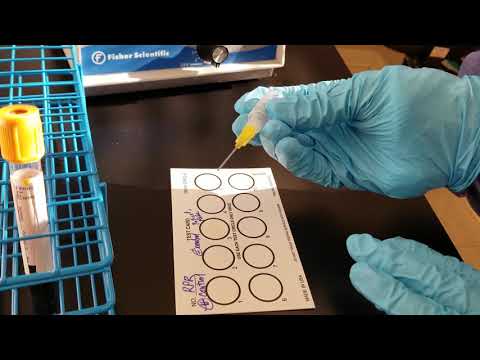 Microbiology:  Rapid Plasma Reagin (RPR) Test