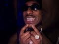 #LoeShimmy shows off his new grillz!!