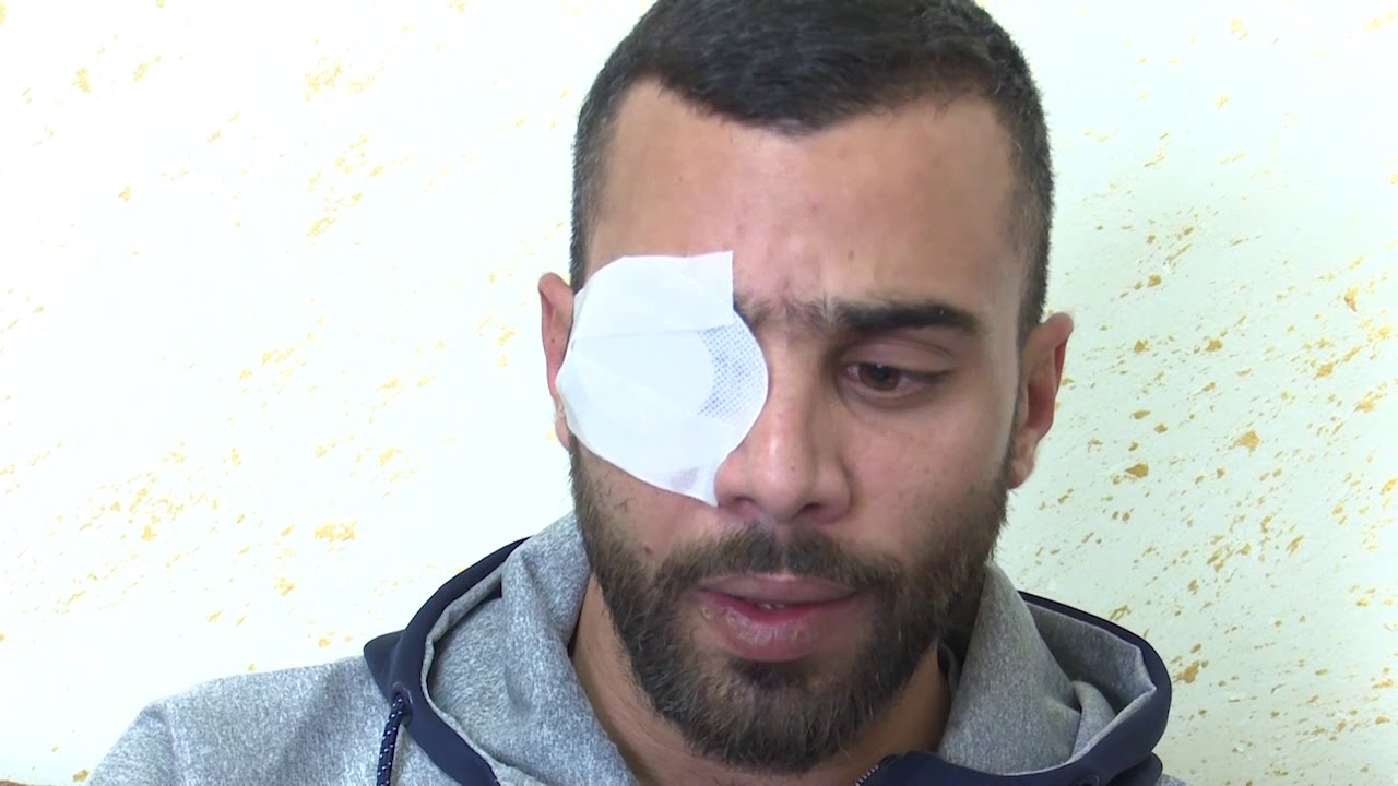 أحمد ذياب من طمرة يتحدث عن فقدانه لعينه بعد مشاركته بجنازة احمد حجازي