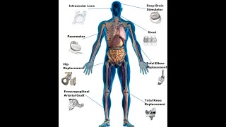 ICD-10-PCS Character 6 Devices
