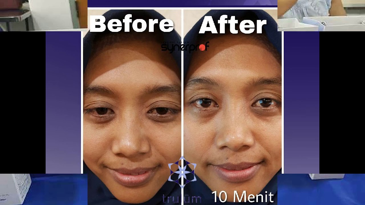 WA 085226234588, Jual trulum synergy skin care di palu