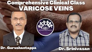 VARICOSE VEINS Clinical Case Presentation