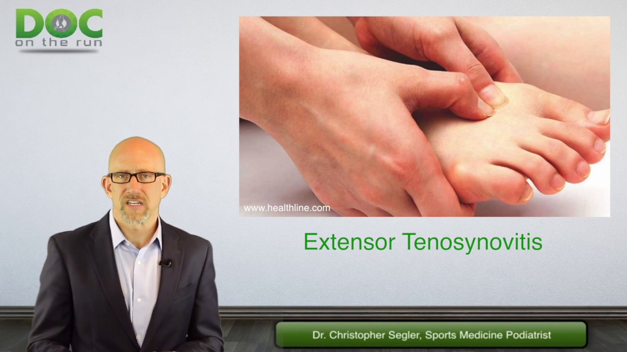 Signs And Symptoms Of Extensor Tenosynovitis In Runners