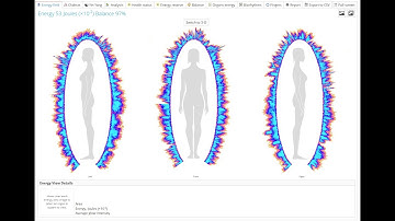 Bio-Well Electrophotonic Imaging Technology Demo