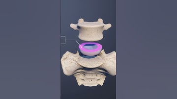The Intervertebral Disc of the L5-S1 Spinal Motion Segment