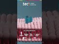 Anatomopathologische Charakterisierung des Hodgkin-Lymphoms | TECH Global University
