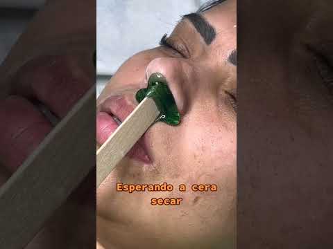 Vídeo: Por que o nariz do meu dragão barbudo está ficando branco?