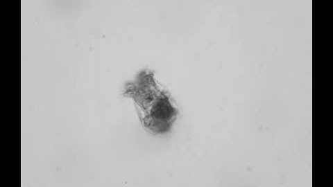 SWIFT microscope what can be found in water