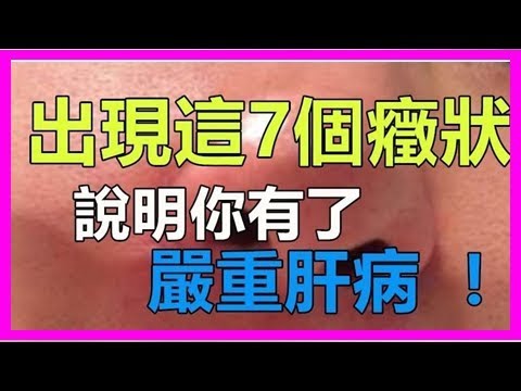 醫生：出現這7個癥狀，說明你有了嚴重肝病 ​！千萬注意！