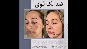 کرم ضد لک قوی 
