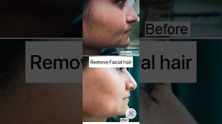 Facial hair remove naturally at home viral video #shorts #short #skin #hairremoval