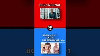 Would you rather be born normal or with one extra chromosome?
