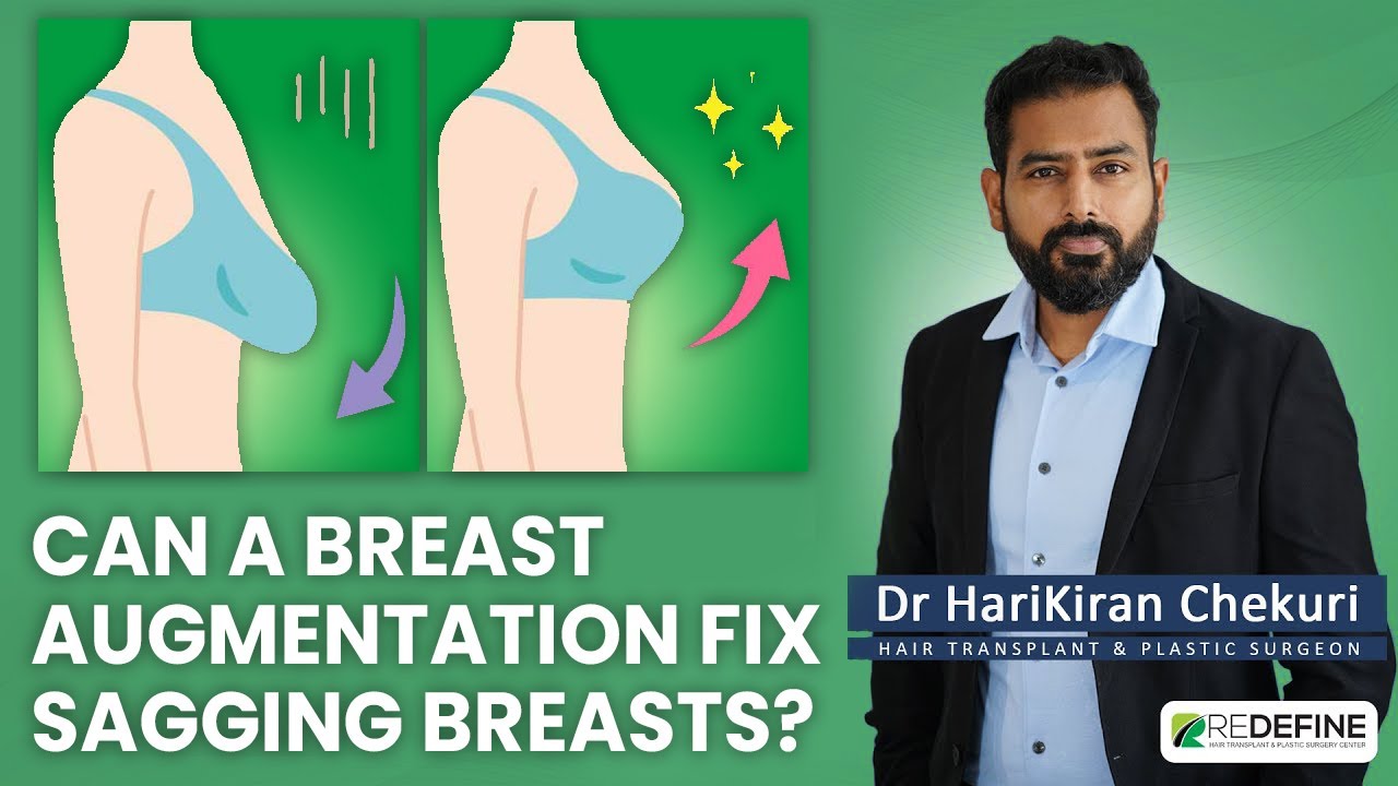 Can A Breast Augmentation Fix Sagging Breasts?