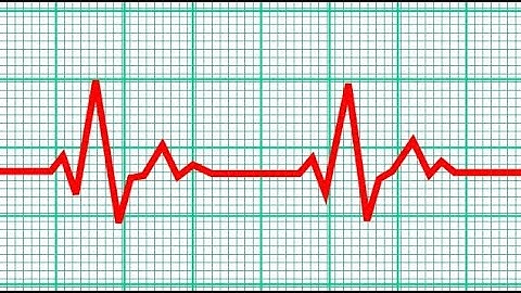 Adobe After Effects - Heart Rate Monitor Effect