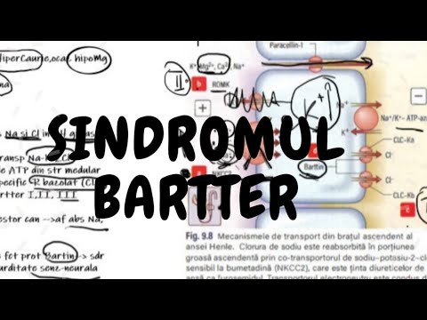 Sindrom Bartter - Hipopotasemia