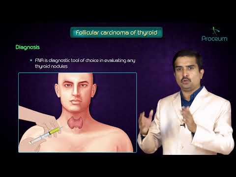 Thyroid neoplasms part 2 ( Follicular carcinoma of thyroid ) - Endocrine pathology