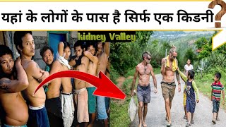 इस गांव के लोगों के पास है सिर्फ एक किडनी ?/incredible fact/#shorts?