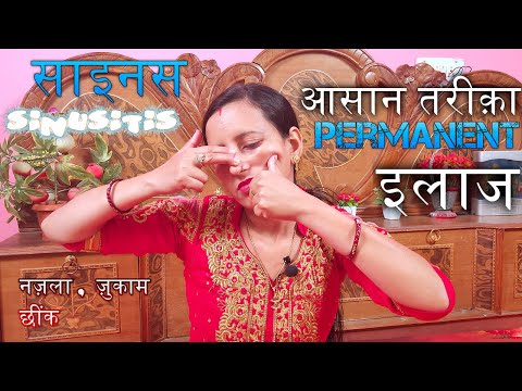 Permanent इलाज । Sinusitis । नज़ला, ज़ुकाम, छींके