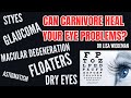 Can my eye problem heal with ketocarnivore diet find out the key to healing
