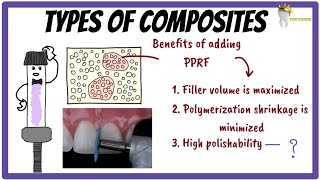 Types of DENTAL COMPOSITES | small particle, microfilled, hybrid, nanofilled composites
