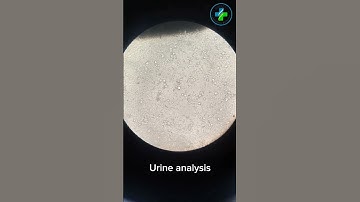 Urine analysis | Urine Microscopic examination | Urine test |pus cells|Red cells #medicallaboratory