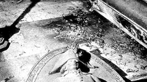 Atom Infant Incubator  Praenatal Segment