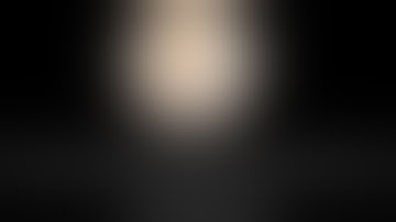 Robotic (SSi Mantra 3) Partial Nephrectomy  For Hilar Tumor