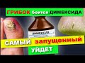 Димексид от грибка спасет и ноги вылечит !