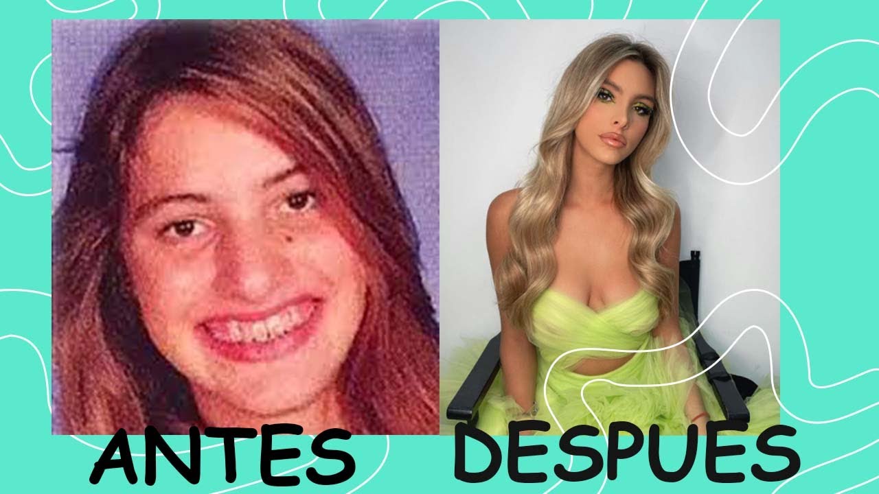 Extensiones en pelo muy corto antes y después