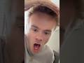 Big forehead filter prank on boyfriend #couple #prank