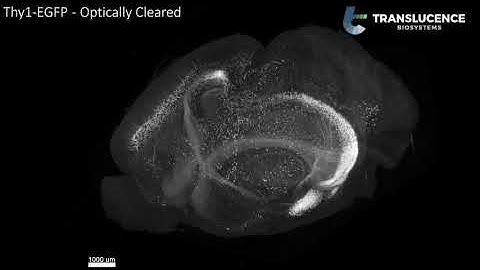 Thy1-GFP Mouse Brain