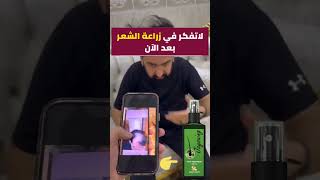 مستحيل تسوي زراعة شعر بعد هذا القيديو 