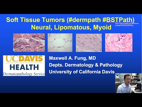 Video: Pob mast cell hlav ulcerate?