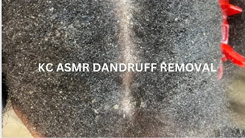 ASMR Dandruff scratch | very flaky