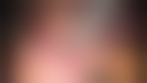 Robotic Surgery - Robotic Total Mesorectal Excision in severely obese female patients