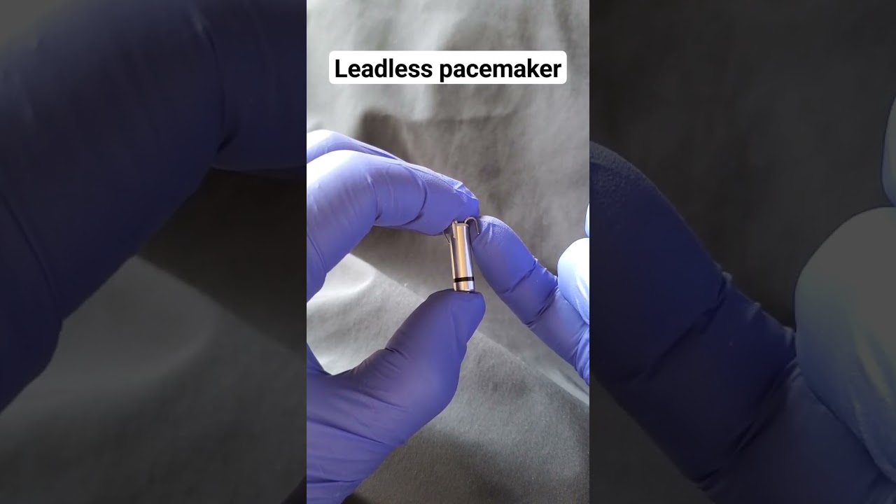 The Leadless pacemaker is an important new tool 