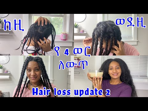 ?የተነቀለው ፀጉሬ እንዴት ተመለሰ የሚታይ ለውጥ ቀጣይ ቪድዮ/ hair loss update video 2￼