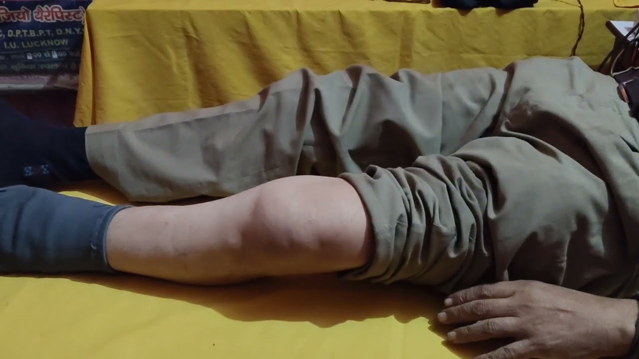 Knee arthritis.sefe exercise 