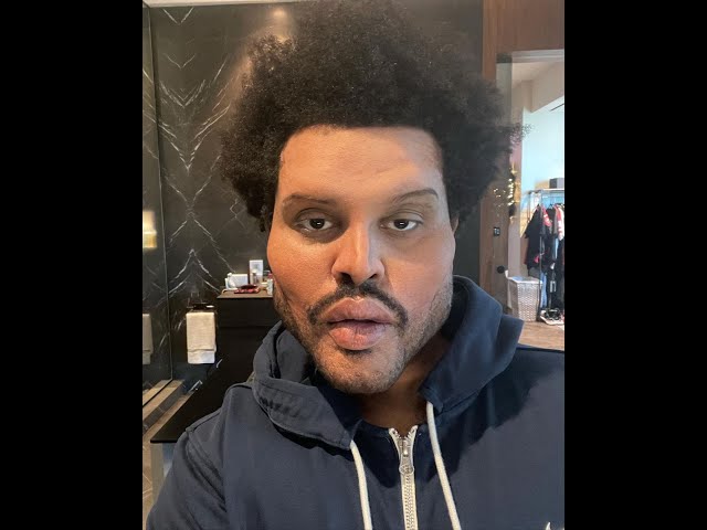 La cara de The Weeknd vuelve a la normalidad