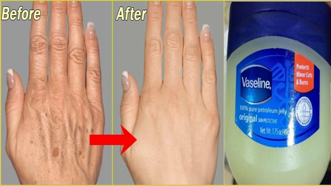 3 दिन में हाथो की झुर्रियां दूर कर सॉफ्ट और सूंदर हाथ पायें-Remove ...