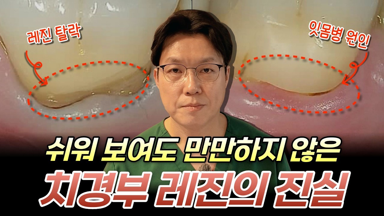 쉬워보이는 치경부 레진, 절대 만만하지 않은 이유 #레진치료 #잇몸패임 #치경부마모증