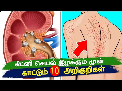 சிறுநீரக பாதிப்புக்கான  10  அறிகுறிகள்  | 10 Signs That Your Kidneys Need Help In Tamil