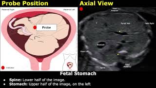 Fetal Stomach Ultrasound Probe Positioning & Scanning Technique For Cephalic Presentations