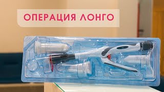 Операция Лонго: почему лечить геморрой не страшно