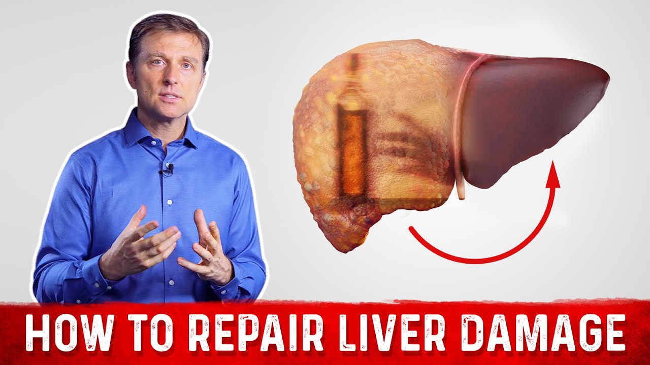 How To Repair Liver Damage After Alcohol? – Dr.Berg On Liver Cirrhosis