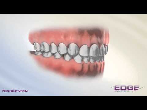 Edge Animations Normal Occlusion (Audio)