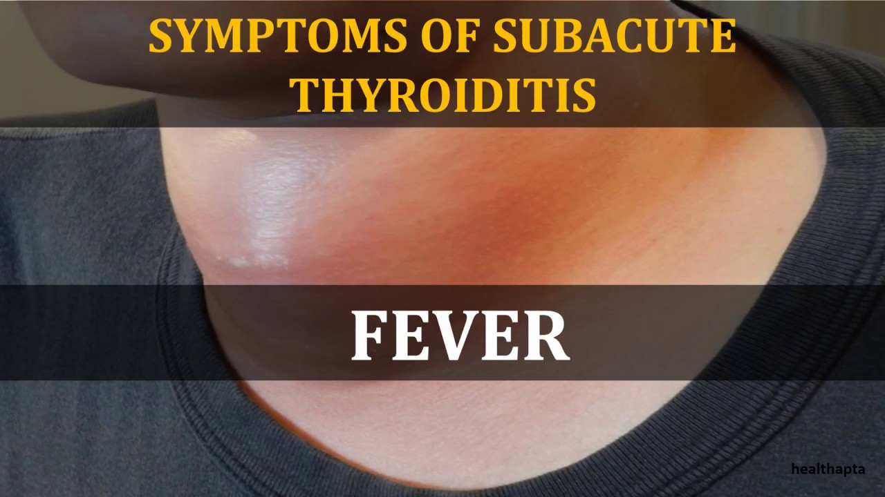 What Is Subacute Thyroiditis and How Can It Be Treated | Dr. Seeds