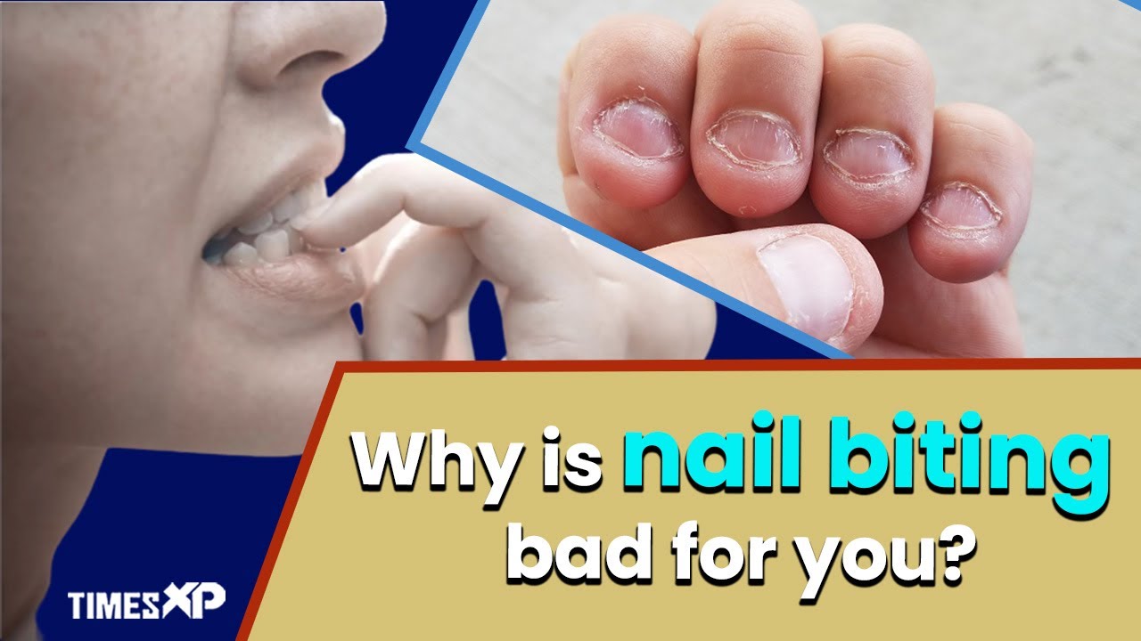 Bite the Stress Away? Nail Biting and Smoking Predict Maladaptive Stress  Coping Strategies | Request PDF